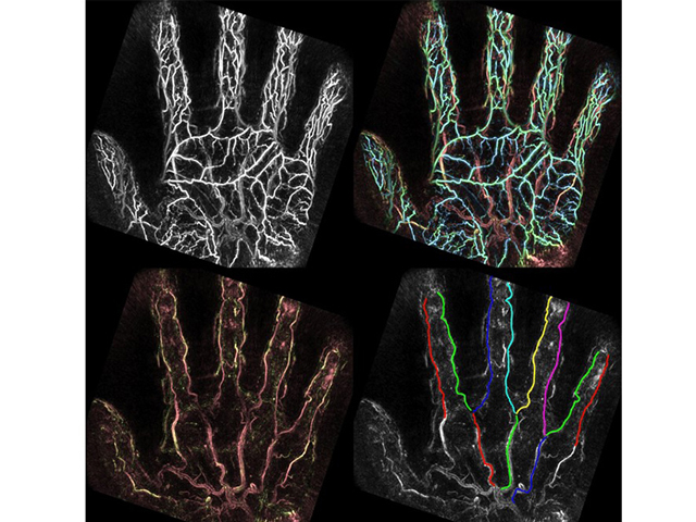 京大，光超音波イメージングで手掌動脈を可視化